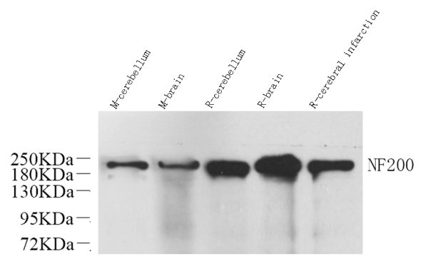 NEFH Polyclonal Antibody (E-AB-70063)