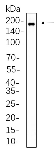 Recombinant Phospho-HER2 (Tyr1221, 1222) Monoclonal Antibody (AN300660L)