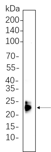 Recombinant ASC Monoclonal Antibody (AN301342L)