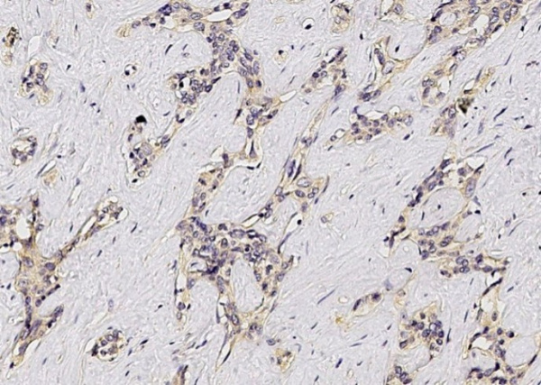 Recombinant ASGPR1 Monoclonal Antibody (AN300205P)