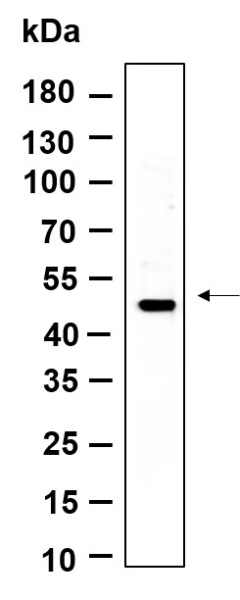 Recombinant LXRα Monoclonal Antibody (AN301127L)