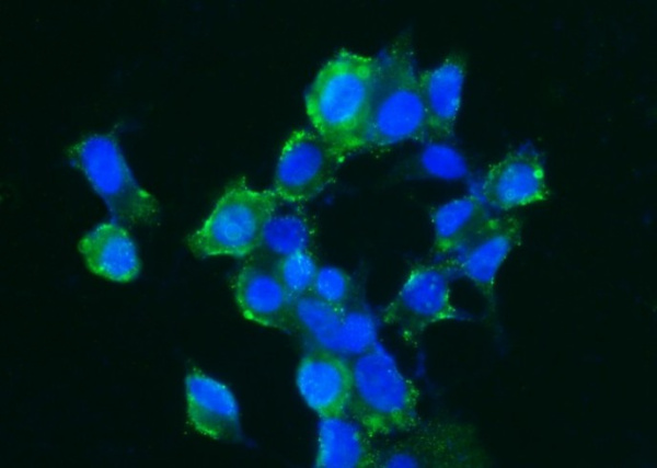 Recombinant Carbonic Anhydrase XIV/CA14 Monoclonal Antibody (AN300091P)