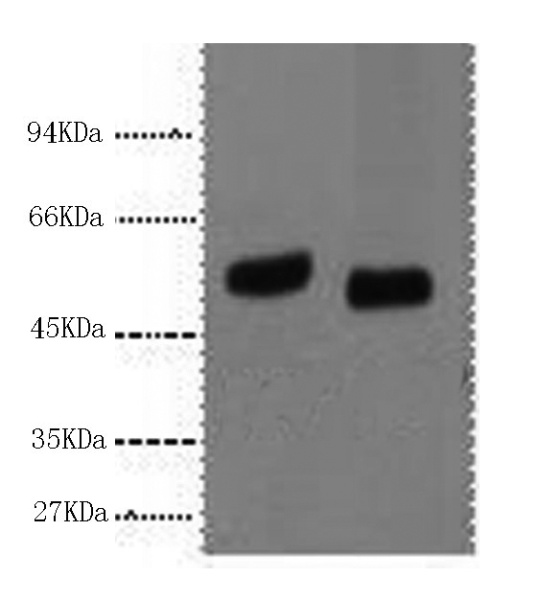 P53 Monoclonal Antibody (E-AB-22015)