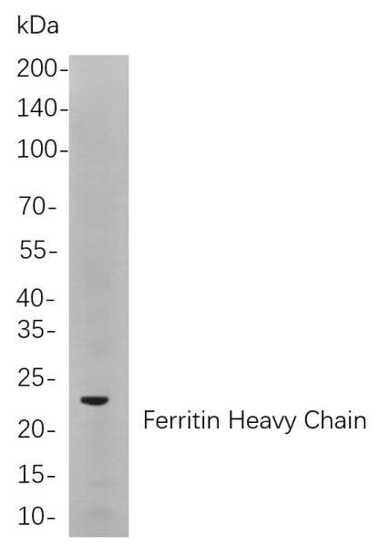 Recombinant Ferritin Heavy Chain Monoclonal Antibody (AN300913L)