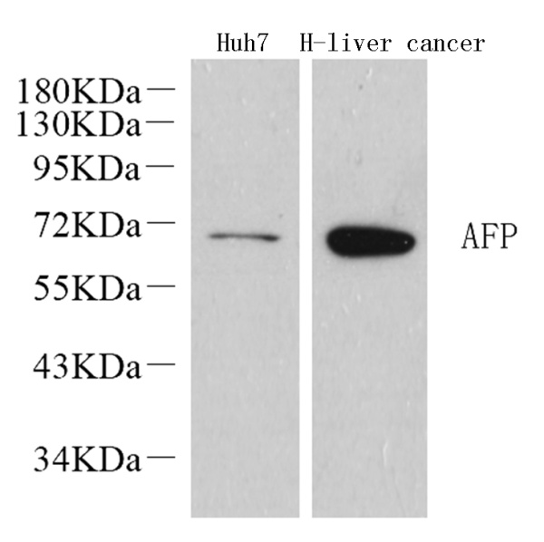 AFP Polyclonal Antibody (E-AB-70145)