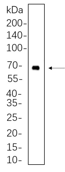 Recombinant BTK Monoclonal Antibody (AN300703L)
