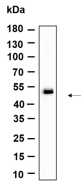 Recombinant TMEM43 Monoclonal Antibody (AN301231L)