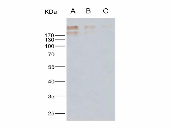 Anti-Human cytomegalovirus(HCMV) Glycoprotein B/gB Monoclonal Antibody (E-AB-V1261)