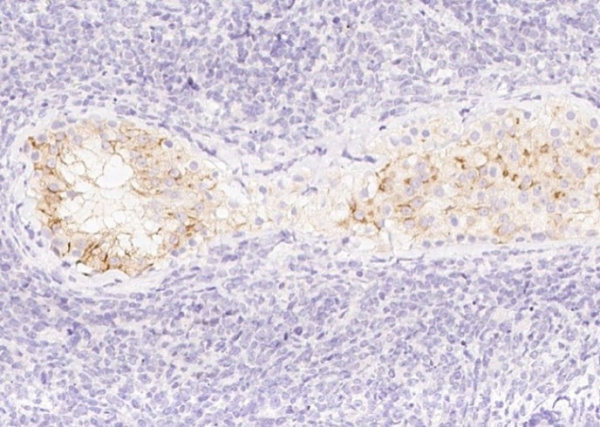 AMH Monoclonal Antibody (AN200148P)