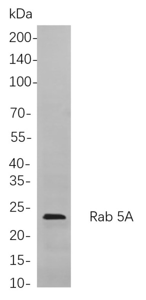 Recombinant Rab 5A Monoclonal Antibody (AN301004L)