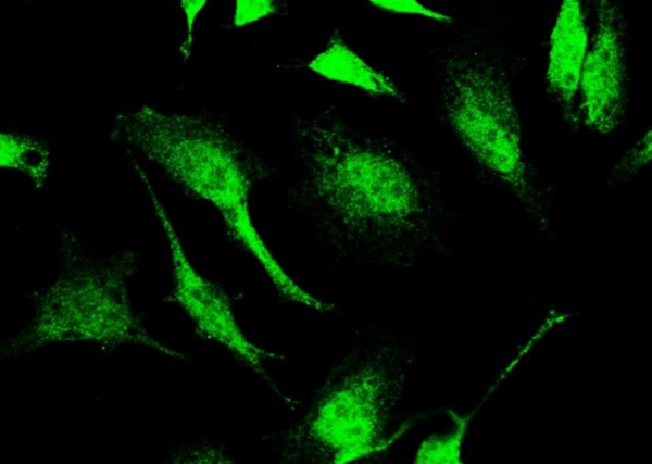 SIRT1 Monoclonal Antibody (AN200054P)