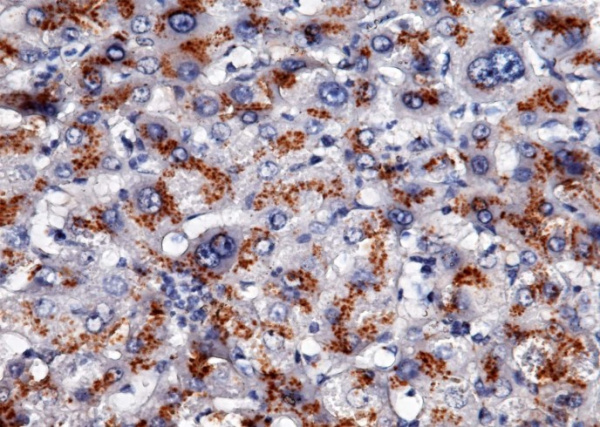 Recombinant Apolipoprotein H/APOH Monoclonal Antibody (AN300392P)