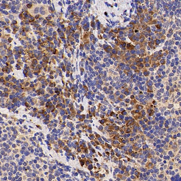 IL2 Polyclonal Antibody (E-AB-70049)