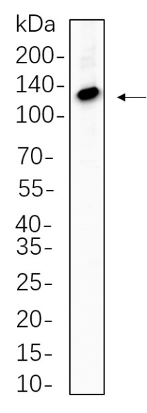 Recombinant ATP-Citrate Lyase Monoclonal Antibody (AN300841L)