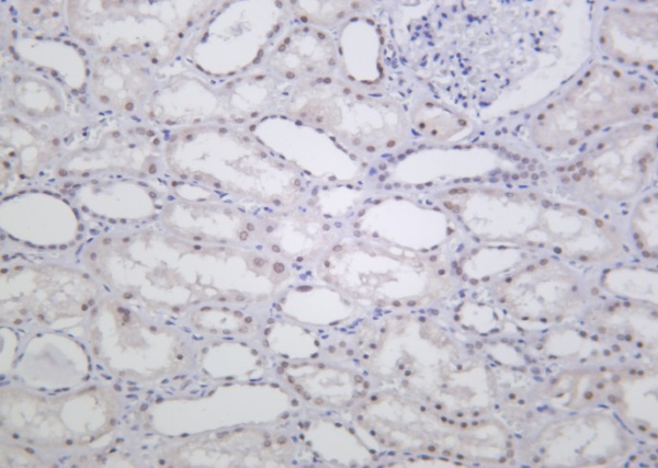 Recombinant ALKBH5 Monoclonal Antibody (AN301255L)
