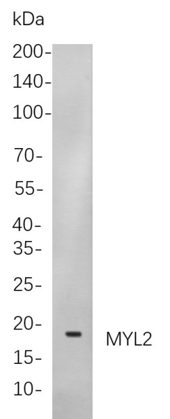 Recombinant Myosin Light Chain 2 Monoclonal Antibody (AN300894L)