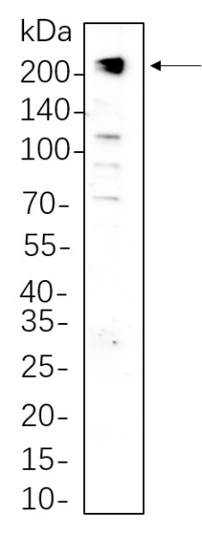 Recombinant PDGFR-β Monoclonal Antibody (AN300813L)