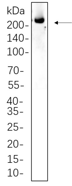 Recombinant ALK Monoclonal Antibody (AN301358L)