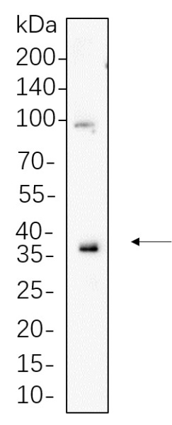 Recombinant MCL1 Monoclonal Antibody (AN301339L)