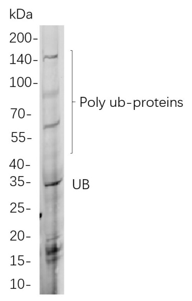 Recombinant Ubiquitin K48 Monoclonal Antibody (AN300944L)