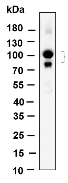 Recombinant CUL4A/B Monoclonal Antibody (AN301180L)