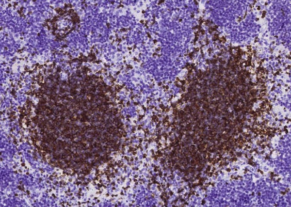 Recombinant CD79B/Ig-beta Monoclonal Antibody (AN300556P)