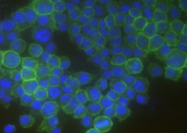 Recombinant CD16-2/FCGR4 Monoclonal Antibody (AN300462P)