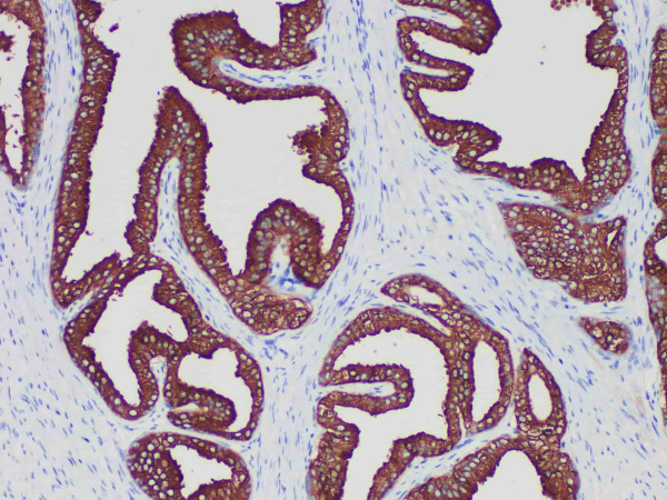 PSA Monoclonal Antibody (ELAB6212-R)
