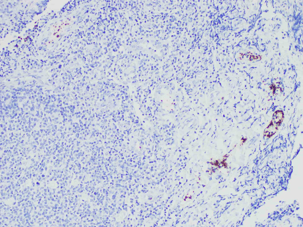 CD61 Monoclonal Antibody (ELAB6117-M)