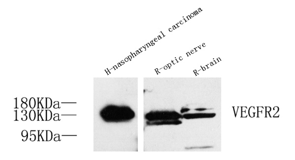 FLK1 Polyclonal Antibody (E-AB-70080)