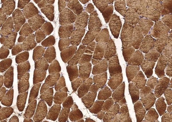 Recombinant Carbonic Anhydrase III/CA3 Monoclonal Antibody (AN300192P)