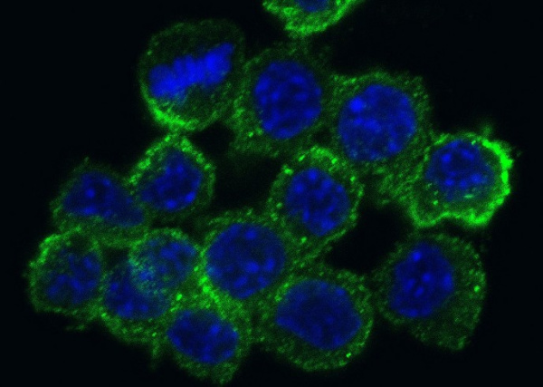 Recombinant MSR1/CD204 Monoclonal Antibody (AN300480P)