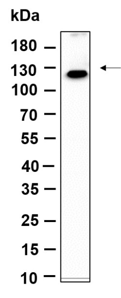 Recombinant MLLT6 Monoclonal Antibody (AN301216L)