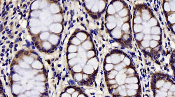 CHOP Polyclonal Antibody (E-AB-70087)