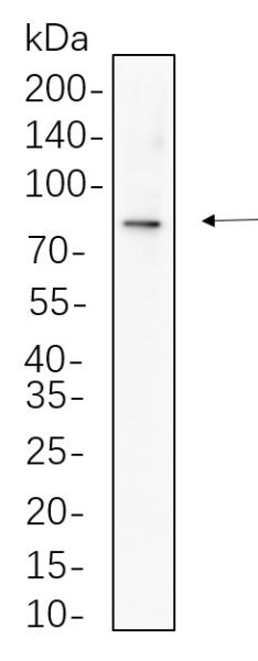 Recombinant Phospho-β Catenin (Ser675) Monoclonal Antibody (AN301306L)