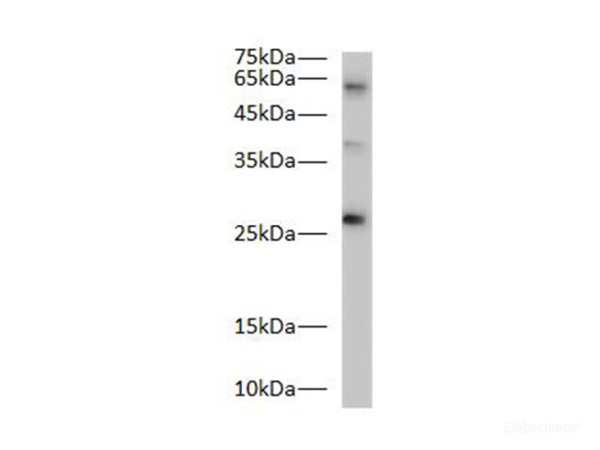 Bcl-2 Polyclonal Antibody (E-AB-40526)