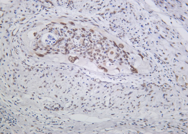Recombinant MRE11 Monoclonal Antibody (AN301268L)