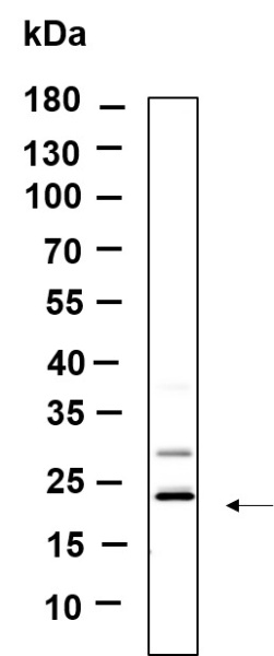 Recombinant KLLN Monoclonal Antibody (AN301224L)