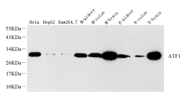 ATF1 Polyclonal Antibody (E-AB-70146)