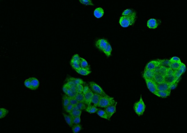 DR5/TRAIL R2 Monoclonal Antibody (AN200049P)