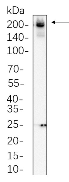 Recombinant Collagen II Monoclonal Antibody (AN301335L)