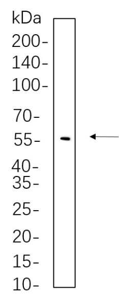 Recombinant Phospho-YAP (Ser127) Monoclonal Antibody (AN300661L)