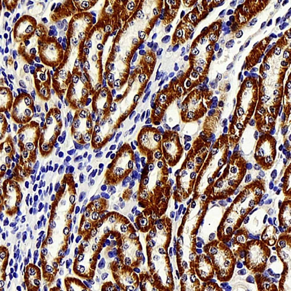 BRAF Polyclonal Antibody (E-AB-70237)