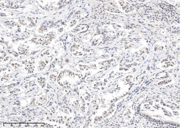 Recombinant Phospho-Stat5 (Tyr694) Monoclonal Antibody (AN300135L)
