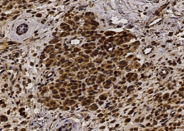 Recombinant bFGF/FGF2 Monoclonal Antibody (AN300097P)