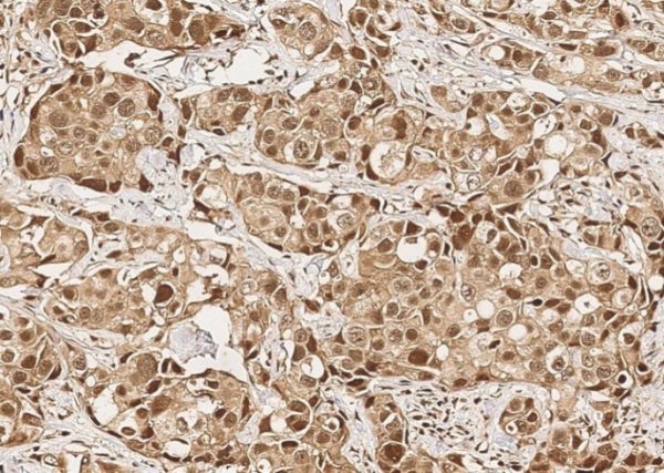 Mcl-1 Monoclonal Antibody (AN200070P)