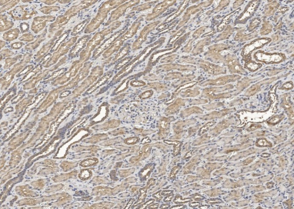 Recombinant HGF Monoclonal Antibody (AN300187P)