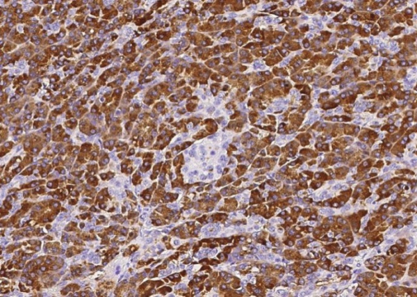Carboxypeptidase A1/CPA1 Monoclonal Antibody (AN200106P)