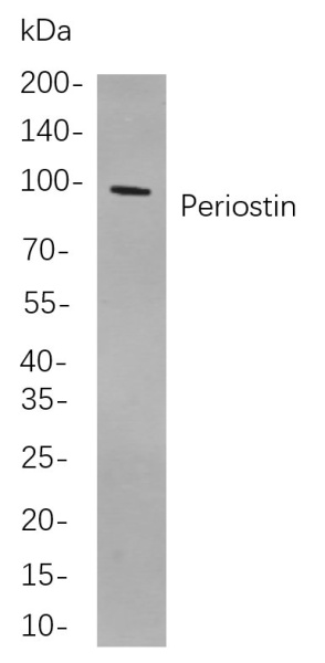 Recombinant Periostin Monoclonal Antibody (AN300918L)