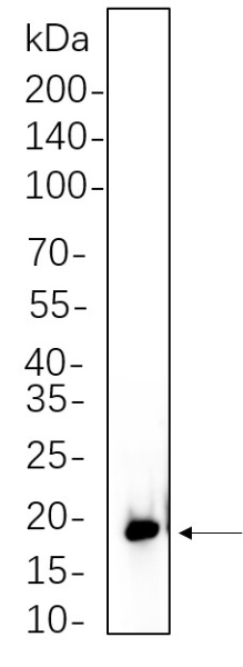 Recombinant Phospho-4E-BP1 (Thr37/46)) Monoclonal Antibody (AN301307L)